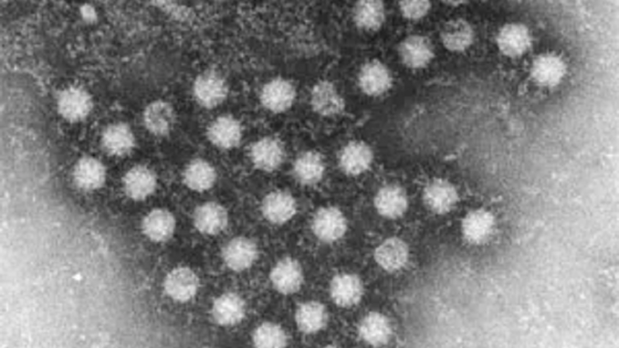 norovirus