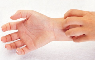 Close up of a woman scratching