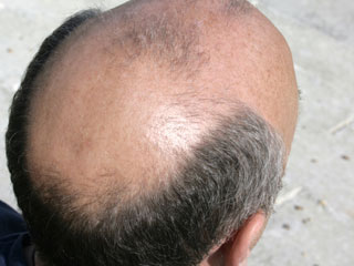 Calvo