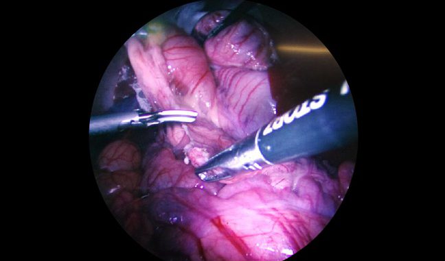 Endoscopio