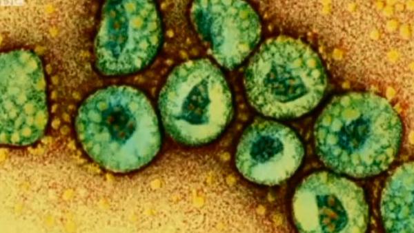 Virus mers