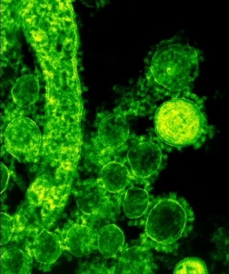 Virus