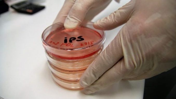 ips