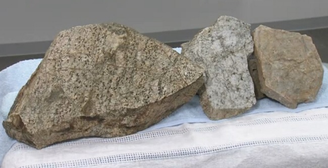 Rocas