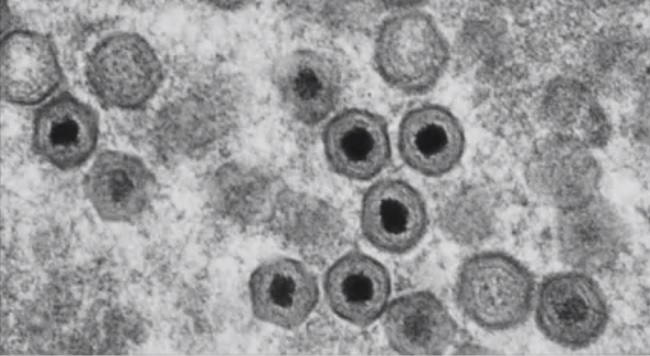 Virus