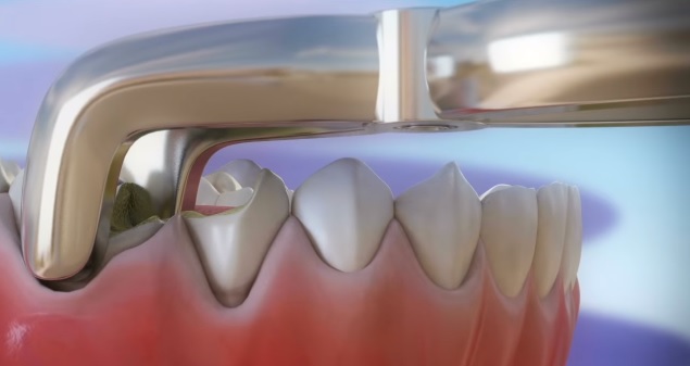 Dientes