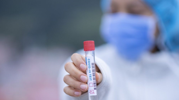 Prueba de coronavirus (Imagen Pixabay)