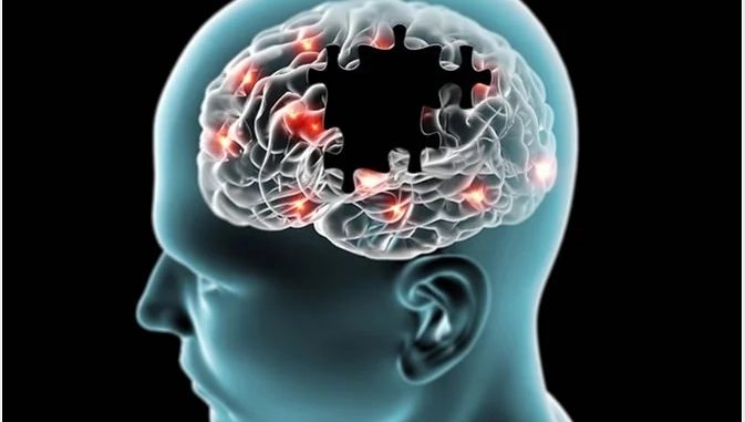 Alzheimer
