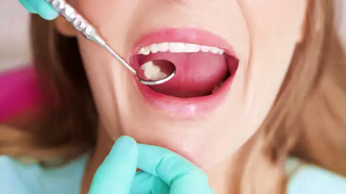 Empaste dental