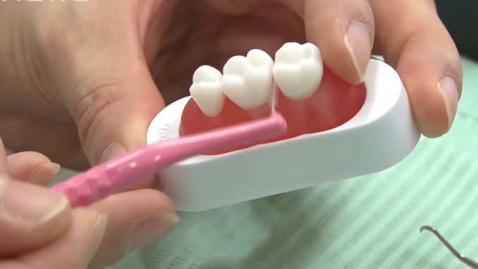 Dientes