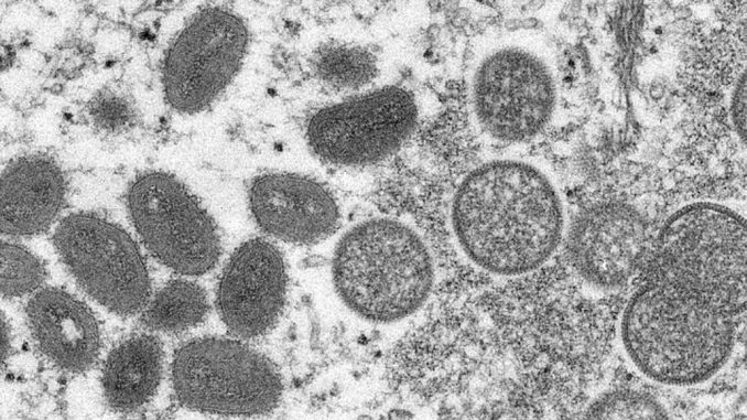 Virus de la viruela del mono