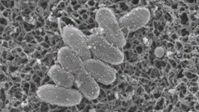 Bacteria de la tos ferina