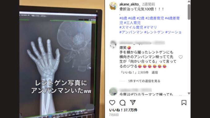 Radiografía con Anpanman, tomada en una clínica japonesa. (Instagram: akane_akito_)